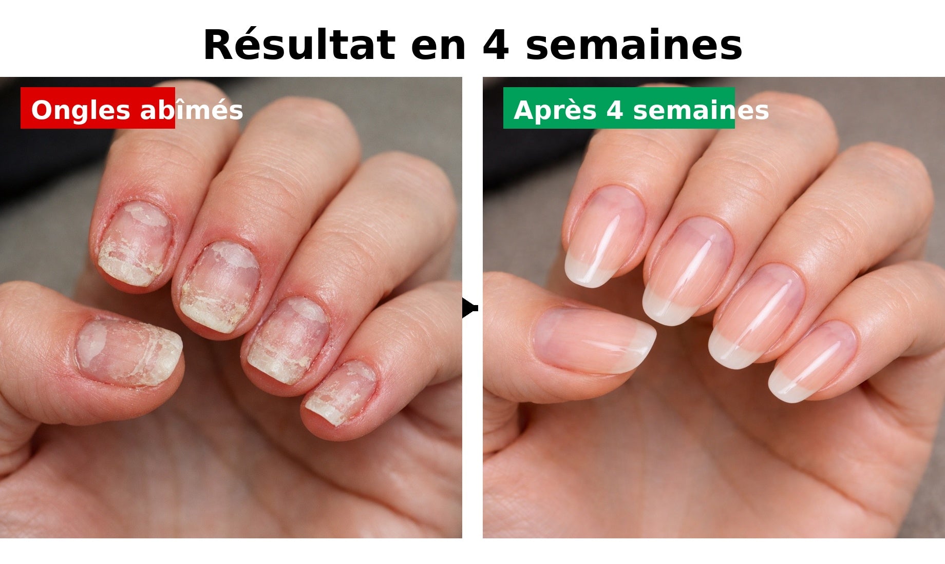 Des ongles plus forts et plus longs en quelques semaines - NUXIANAIL